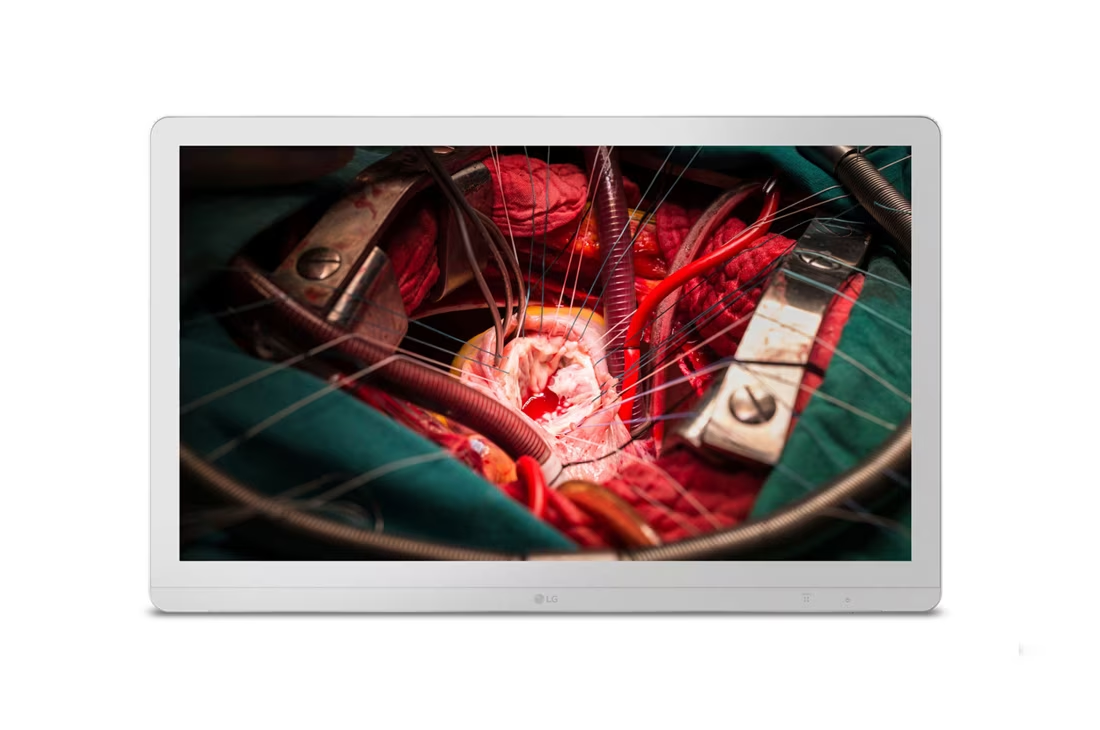 27 (68.58cm) UHD 8MP Surgical Monitor